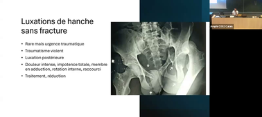 Traumatologie du 15.10.25