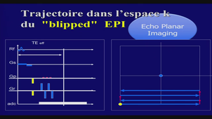 AMIENS-PASS_20241119-080030_S1R1.m4v