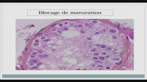 AMIENS-PASS_20250116-100041_S1R1.m4v