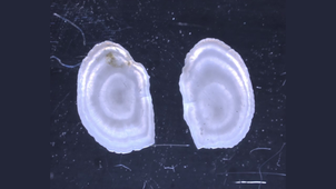 IFSEA - 7. Les otholites