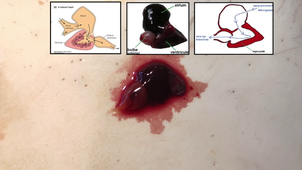 IFSEA- 6. Appareil circulatoire